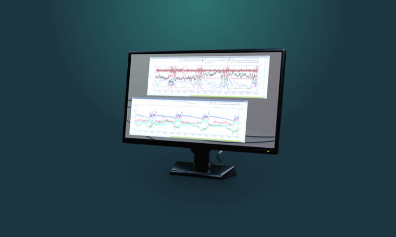 Operation analysis Operation analysis illustration